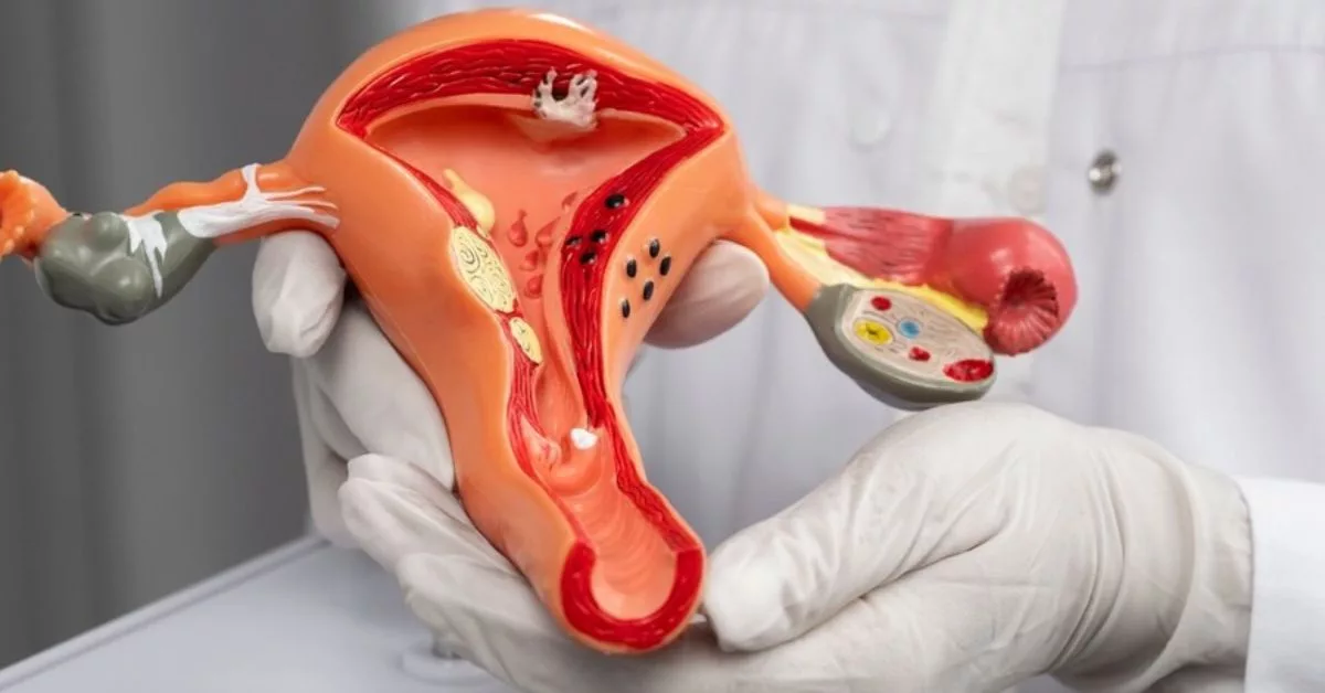 Kehamilan Ektopik Hampir Cukup Bulan: Kisah Menyentuh Hati Ibu Temui Bayi Ketika Pembedahan