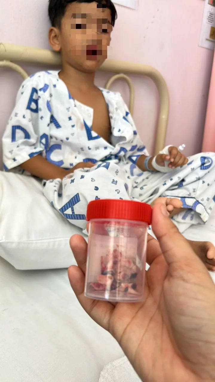 Karies Botol: “Kenapa Gigi Anak Saya Dicabut Semua?” Luahan Penuh Emosi Seorang Ibu Tentang Kesakitan dan Kelegaan