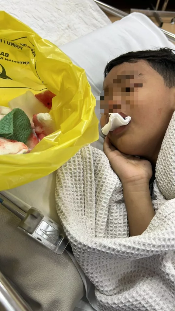 Karies Botol: “Kenapa Gigi Anak Saya Dicabut Semua?” Luahan Penuh Emosi Seorang Ibu Tentang Kesakitan dan Kelegaan