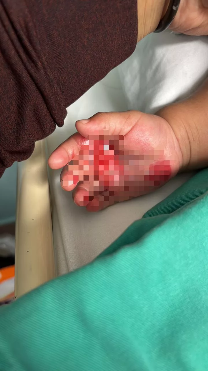 Bahaya Besi Panas: Kisah Menyentuh Hati Yang Jadi Amaran Penting Untuk Ibu Bapa 6 Bahaya Besi Panas: Kisah Menyentuh Hati Yang Jadi Amaran Penting Untuk Ibu Bapa