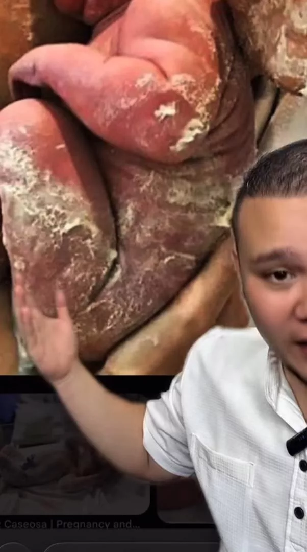 Yang Putih Pada Badan Bayi Baru Lahir Bukan Air Mani , Ini Fungsi Vernix Caseosa