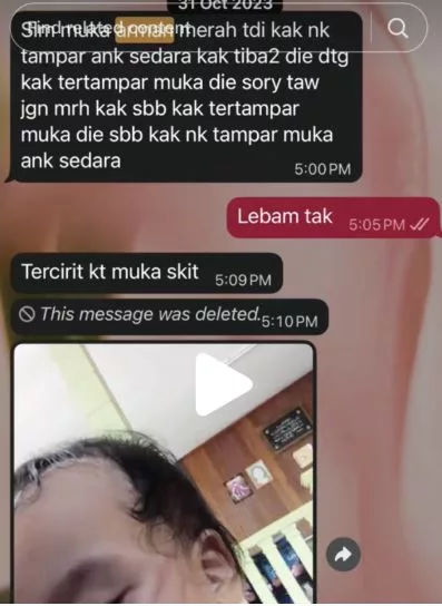 “Tolong Maafkan Ibu…” Pesanan WhatsApp Bongkar Penganiayaan Anak Oleh Pengasuh