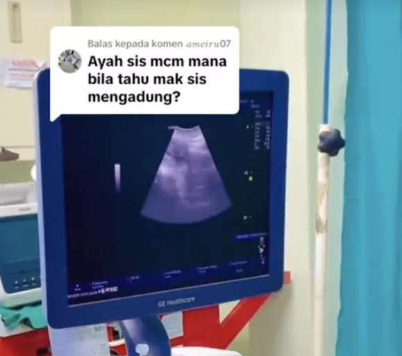 Hamil Usia 51 Tahun Disangka Sakit Badan, Rupanya Rezeki Besar Tak Disangka