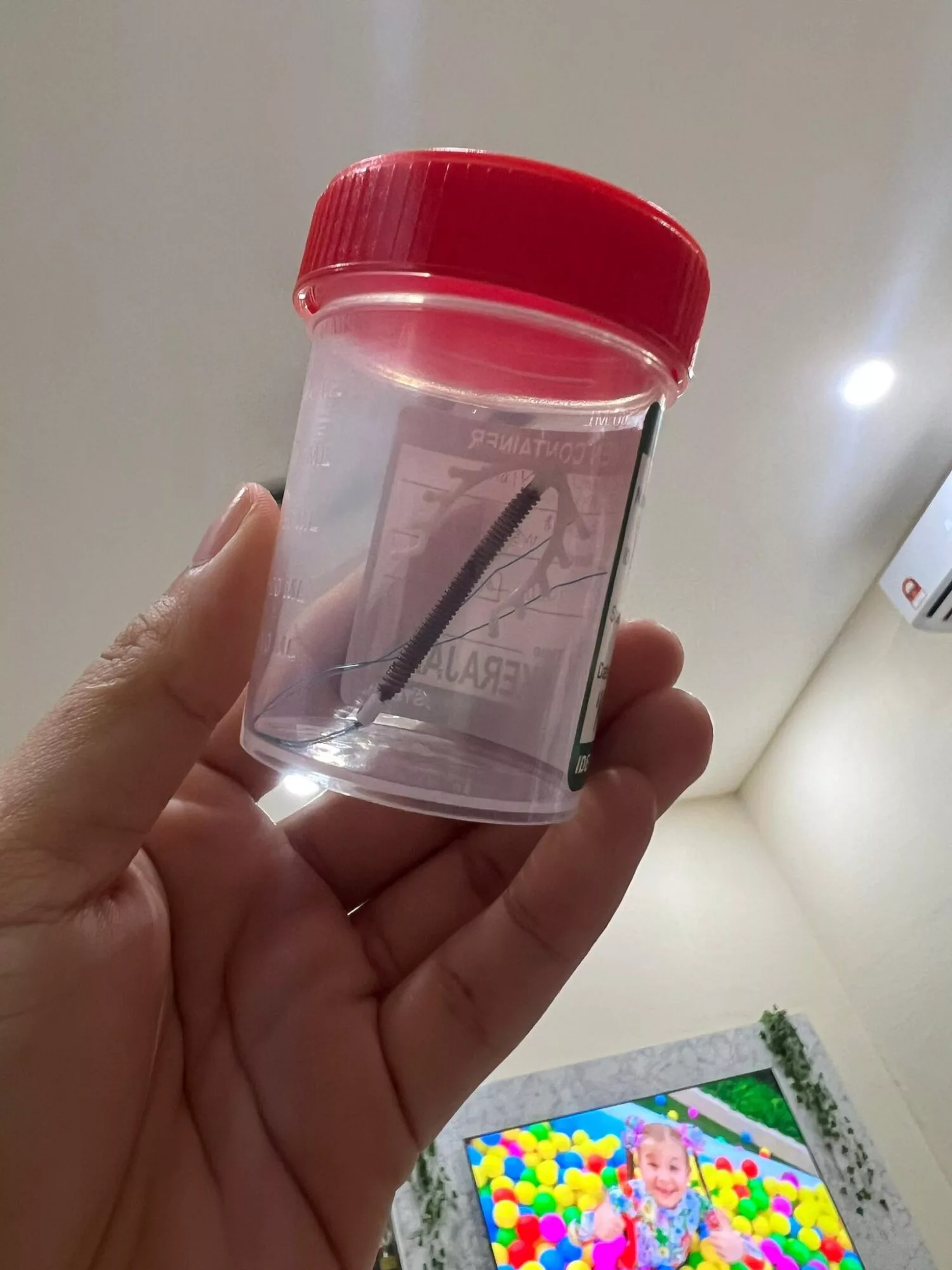 Kronologi Kesilapan Pemasangan IUCD: Ibu Muda Hampir Maut Akibat Apendiks Pecah & Rahim Bocor 5 Kronologi Kesilapan Pemasangan IUCD: Ibu Muda Hampir Maut Akibat Apendiks Pecah & Rahim Bocor