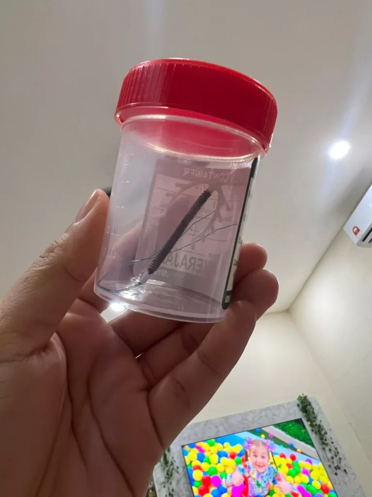 Doktor Salah Pasang IUCD, Rahim Tembus & Hidup Ibu Dua Anak Berubah Selamanya 8 Doktor Salah Pasang IUCD, Rahim Tembus & Hidup Ibu Dua Anak Berubah Selamanya