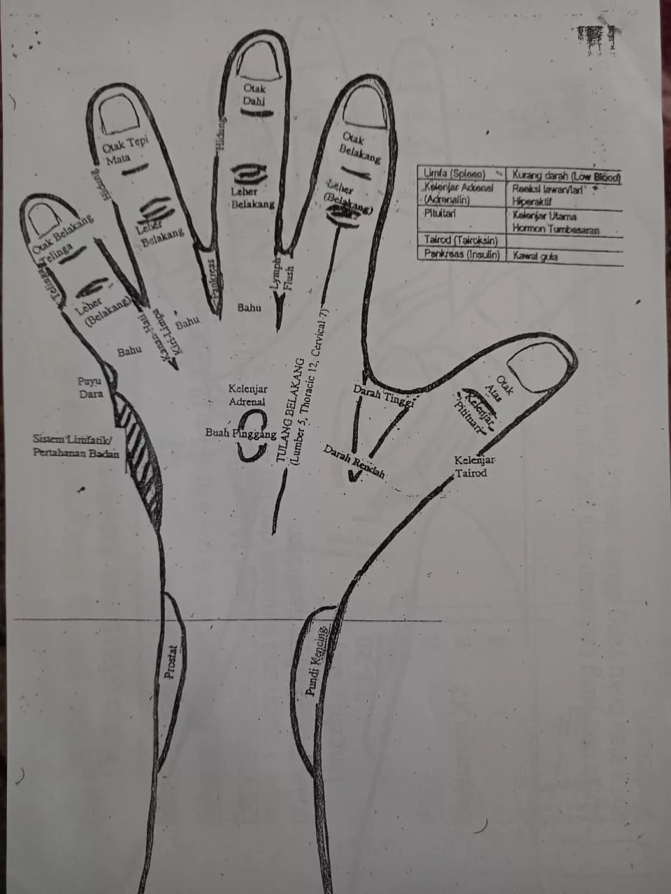 Cara Atasi Sembelit Anak Dengan Urutan Tangan, Kaedah Lembut & Selamat Tanpa Trauma 9 Cara Atasi Sembelit Anak Dengan Urutan Tangan, Kaedah Lembut & Selamat Tanpa Trauma