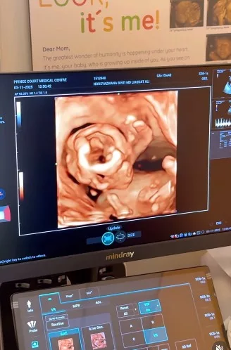 Wanna Ali Luah Syukur Bakal Timang Cahaya Mata “Allah Telah Menulis Semula...” 9 Wanna Ali Luah Syukur Bakal Timang Cahaya Mata “Allah Telah Menulis Semula…”