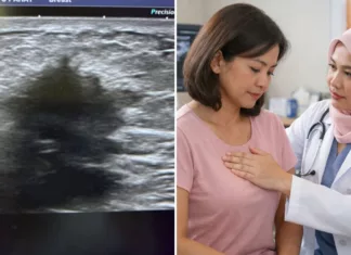 Doktor Luah Rasa Risau: Kanser Payudara Semakin Muda & Ancaman Senyap Buat Wanita