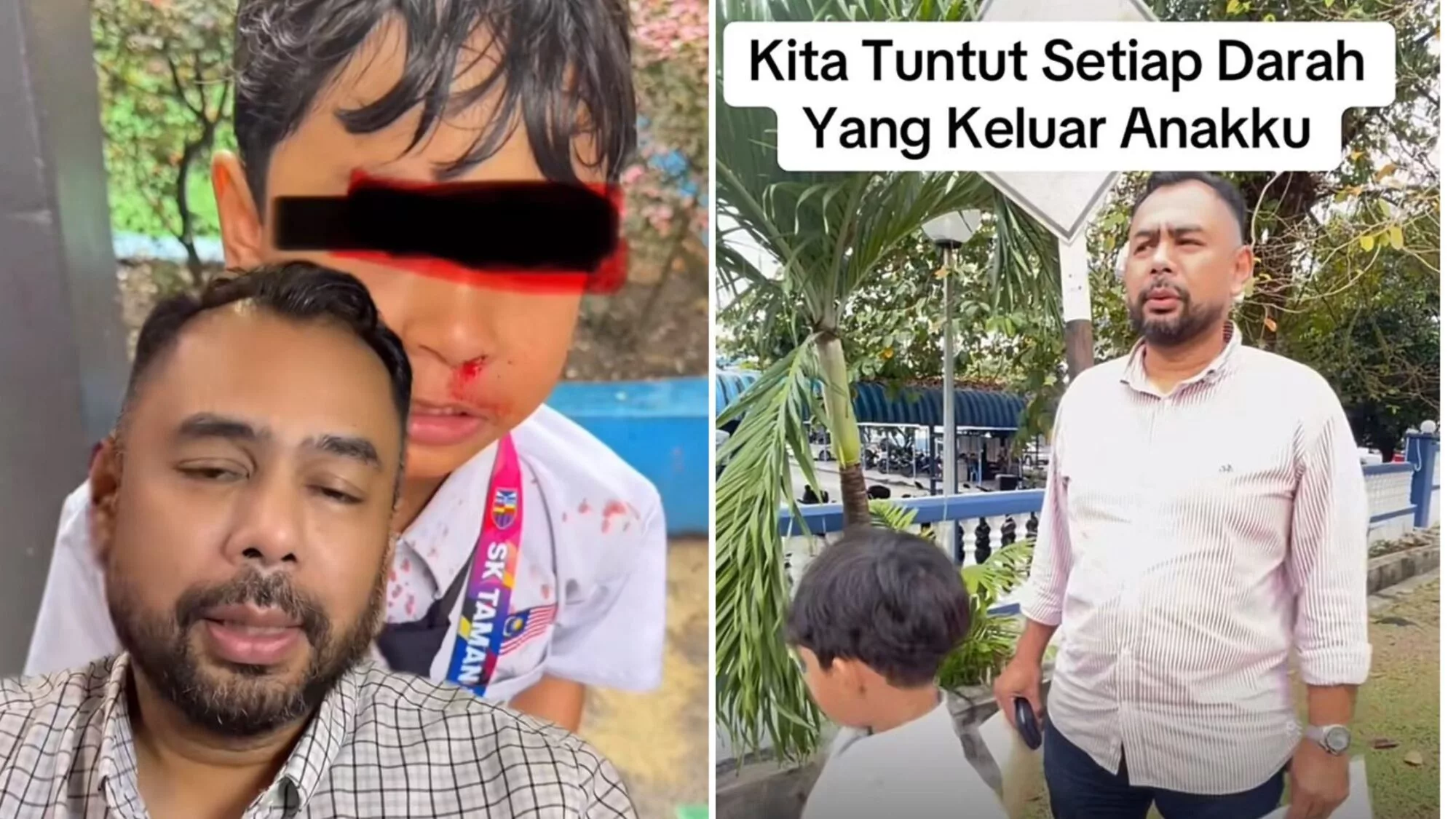 “Kita Tuntut Setiap Darah Yang Keluar Anakku”, Bapa Luah Kecewa Anak Ditampar Rakan Sekolah Hingga Berdarah 39 “Kita Tuntut Setiap Darah Yang Keluar Anakku”, Bapa Luah Kecewa Anak Ditampar Rakan Sekolah Hingga Berdarah