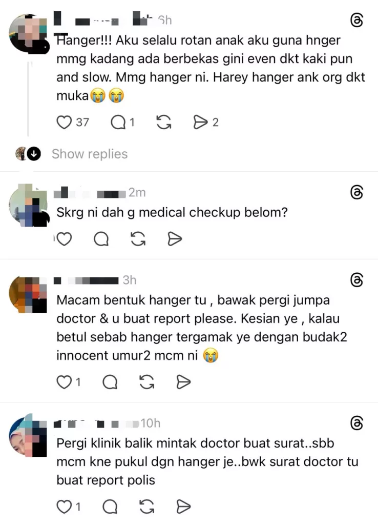 Ibu Risau, Wajah Anak Bawah Jagaan Pengasuh Ada Kesan Birat Seperti ‘Hanger’ 10 Ibu Risau, Wajah Anak Bawah Jagaan Pengasuh Ada Kesan Birat Seperti ‘Hanger’