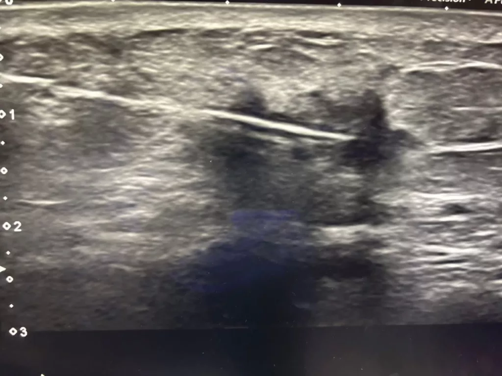 Jumpa Pesakit Kanser Setiap Hari, Pakar Radiologi Luah Risau Tentang Kanser Payudara