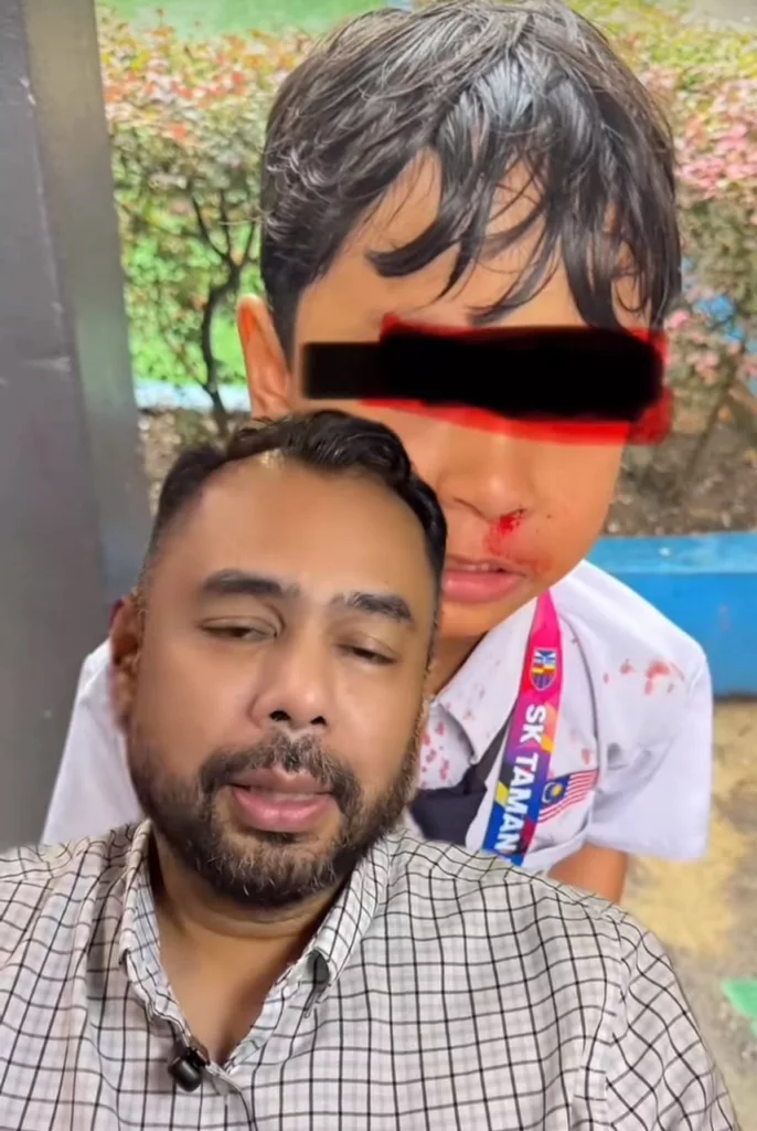 “Kita Tuntut Setiap Darah Yang Keluar Anakku”, Bapa Luah Kecewa Anak Ditampar Rakan Sekolah Hingga Berdarah