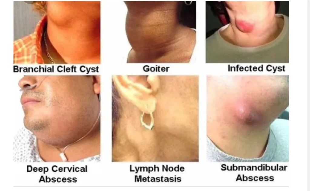 Jangan Ambil Mudah Anak Demam Lebih Tiga Hari, Ini Nasihat Penting Doktor Yang Ramai Abaikan