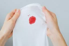 Spotting Awal Kehamilan 1–12 Minggu, Normal Atau Tanda Bahaya? Ini Penjelasan Lengkap 8 Spotting Awal Kehamilan 1–12 Minggu, Normal Atau Tanda Bahaya? Ini Penjelasan Lengkap