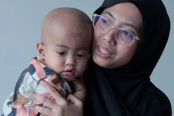 Kanak-Kanak 2 Tahun Hidap Kanser Neuroblastoma Tahap 4, Mata Tiba-Tiba Sepet Lepas Lahir!