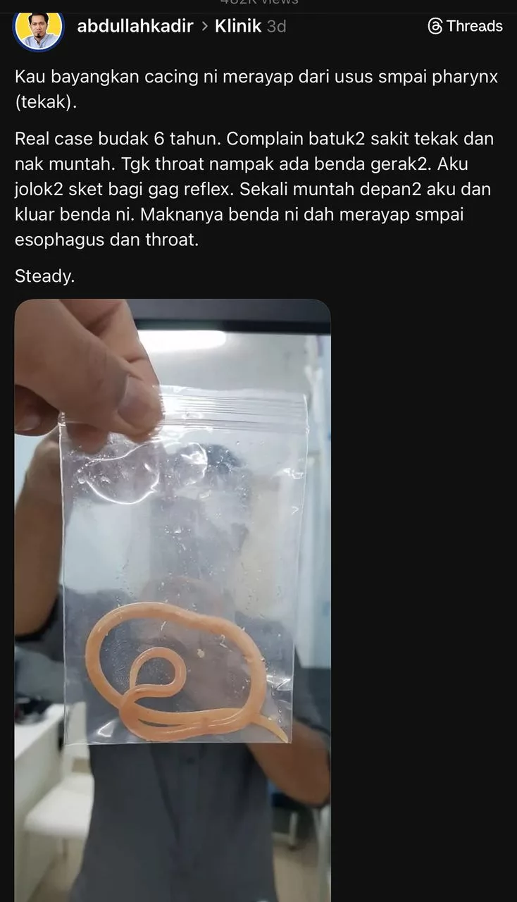 Kanak-Kanak Muntah Cacing Gelang: Kes Mengejutkan Yang Buat Ibu Bapa Tersentak