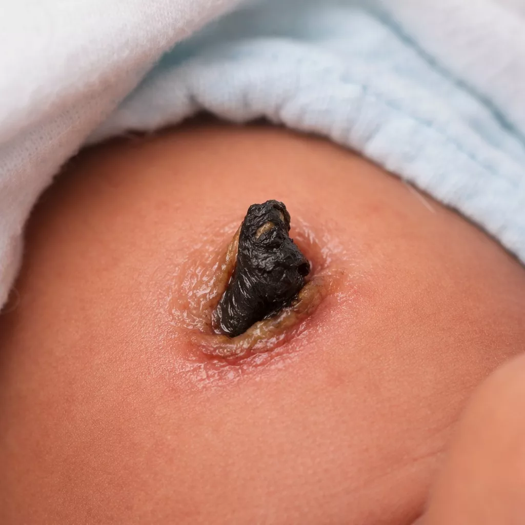 Tali Pusat Bayi Masih Bergayut? Jangan Panik, Ini Cara Penjagaan Yang Betul