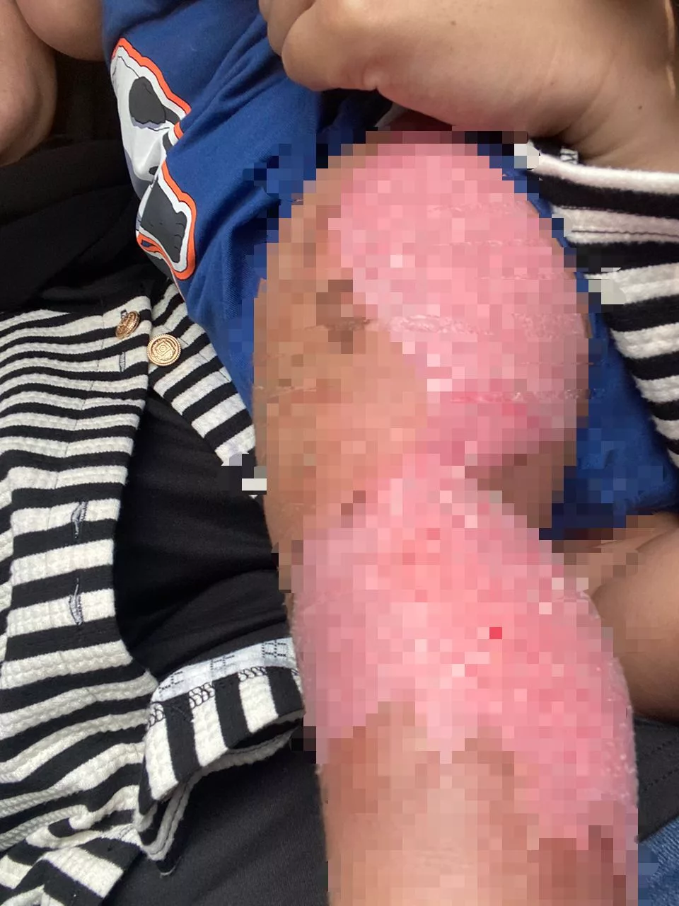 Bapa Terkejut Air Paip Tiba-Tiba Jadi Panas Ketika Bersihkan Anak, Kaki Melecur Teruk 19 Bapa Terkejut Air Paip Tiba-Tiba Jadi Panas Ketika Bersihkan Anak, Kaki Melecur Teruk