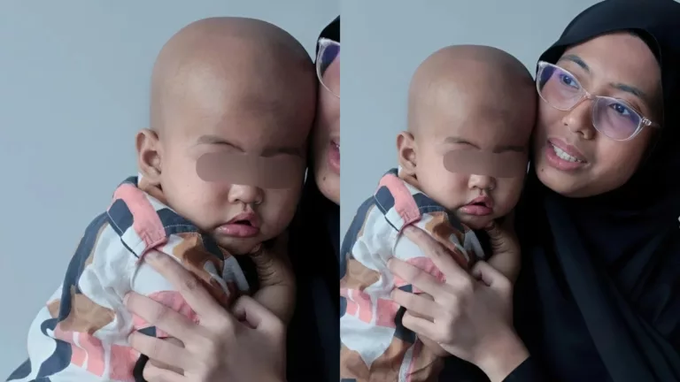 Kanak-Kanak 2 Tahun Hidap Kanser Neuroblastoma Tahap 4, Mata Tiba-Tiba Sepet Lepas Lahir!