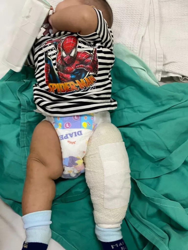 Bapa Terkejut Air Paip Tiba-Tiba Jadi Panas Ketika Bersihkan Anak, Kaki Melecur Teruk 13 Bapa Terkejut Air Paip Tiba-Tiba Jadi Panas Ketika Bersihkan Anak, Kaki Melecur Teruk