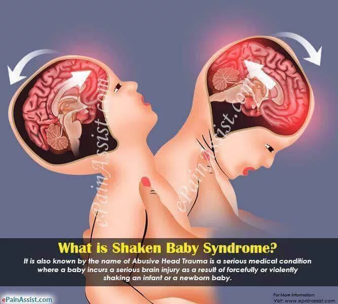 Jangan Goncang Bayi! Perbuatan Nampak Biasa Ini Boleh Sebabkan Kecederaan Otak 6 Jangan Goncang Bayi! Perbuatan Nampak Biasa Ini Boleh Sebabkan Kecederaan Otak