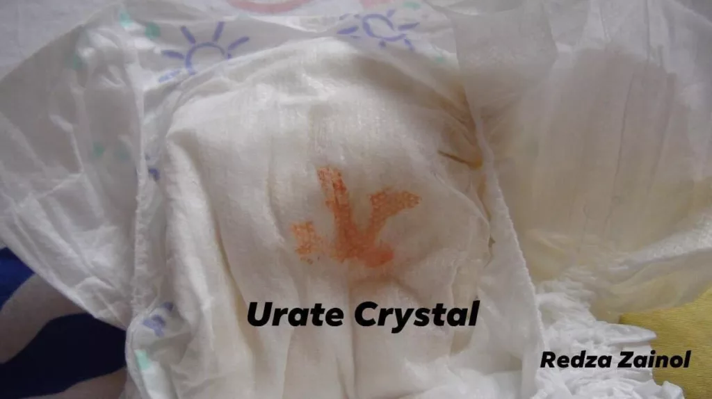 Ini 4 Petanda Yang Ibu Ayah Perlu Tahu Jika Bayi Kurang Minum Susu Badan 8 Ini 4 Petanda Yang Ibu Ayah Perlu Tahu Jika Bayi Kurang Minum Susu Badan