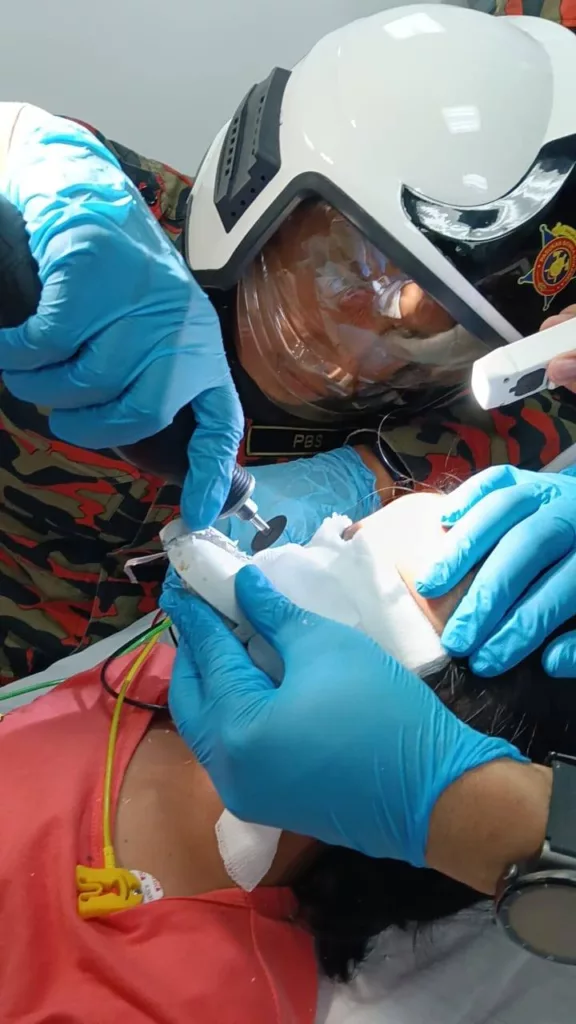 Sifat Ingin Mencuba Buat Bibir Kanak-Kanak 8 Tahun Tersepit Pengepit Kuku Elektrik!