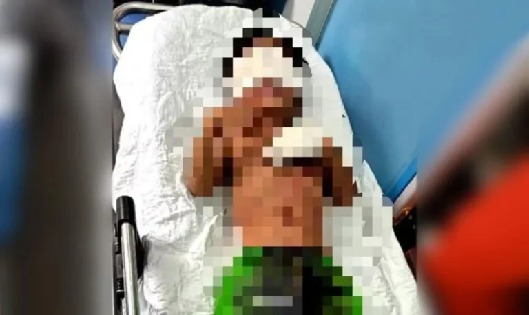 Padah Bermain Mercun, Kanak-Kanak 4 Tahun Putus Jari! 5 Padah Bermain Mercun, Kanak-Kanak 4 Tahun Putus Jari!