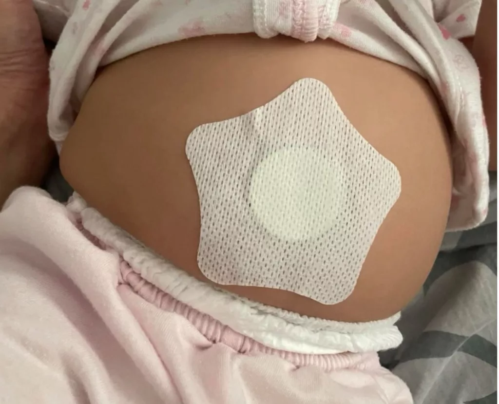Nampak Mudah, Tapi Bahaya? Tular Patch Sembelit Bayi, Doktor Tampil Jelaskan Risiko Sebenar