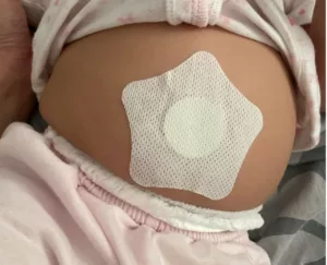 Nampak Mudah, Tapi Bahaya? Tular Patch Sembelit Bayi, Doktor Tampil Jelaskan Risiko Sebenar