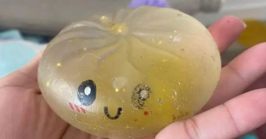 Kanak-Kanak Melecur Di Muka, Panaskan ‘Squishy Toys’ Dalam Microwave