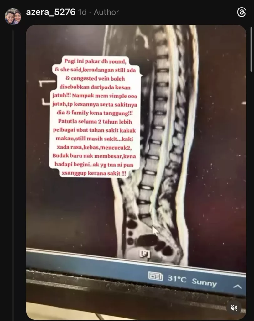 Mangsa Tarik Kerusi Derita Menanggung Sakit, Ibu Tuntut Keadilan