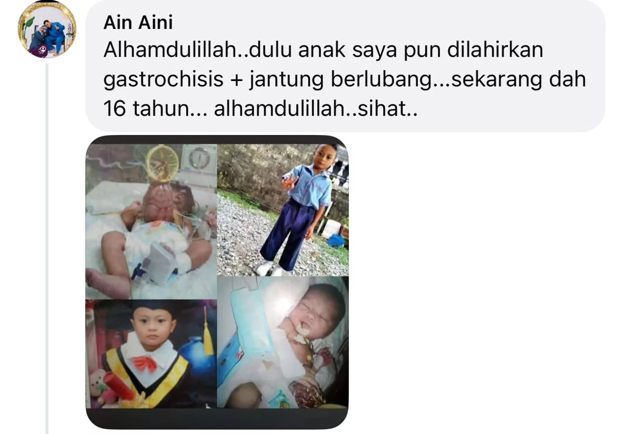 “Masa Scan Doktor Cakap Usus Bayi Di Luar Perut…” Ibu Ini Kongsi Perjalanan Anak Hidap Gastroschisis 12 “Masa Scan Doktor Cakap Usus Bayi Di Luar Perut…” Ibu Ini Kongsi Perjalanan Anak Hidap Gastroschisis