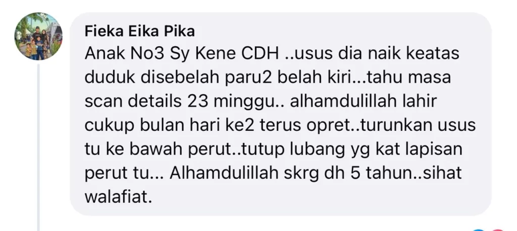 “Masa Scan Doktor Cakap Usus Bayi Di Luar Perut…” Ibu Ini Kongsi Perjalanan Anak Hidap Gastroschisis