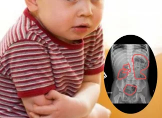 Anak Mengadu Sakit Perut Rupanya Najis Terkumpul Dalam Usus, Ini Buat Ramai Ibu Bapa Tersedar