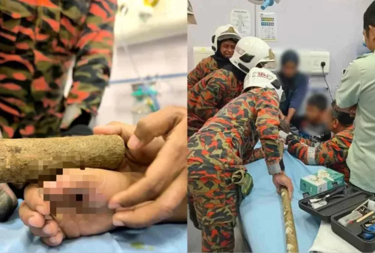 Paku Tertusuk Tapak Tangan Budak 6 Tahun, Bomba Terpaksa Potong Kayu Sepanjang 1 Meter!
