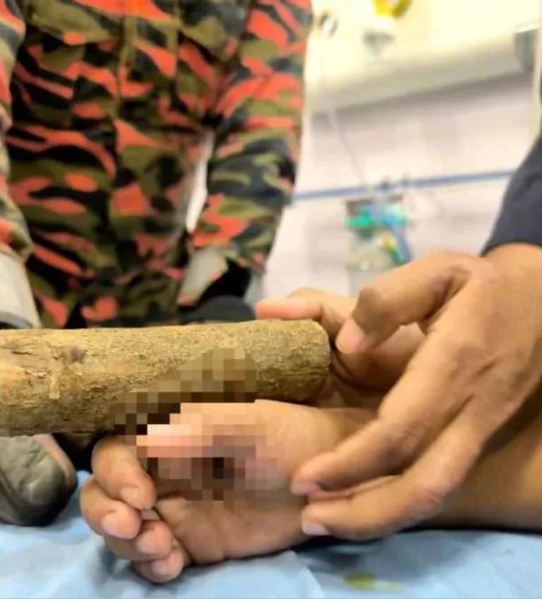 Paku Tertusuk Tapak Tangan Budak 6 Tahun, Bomba Terpaksa Potong Kayu Sepanjang 1 Meter!