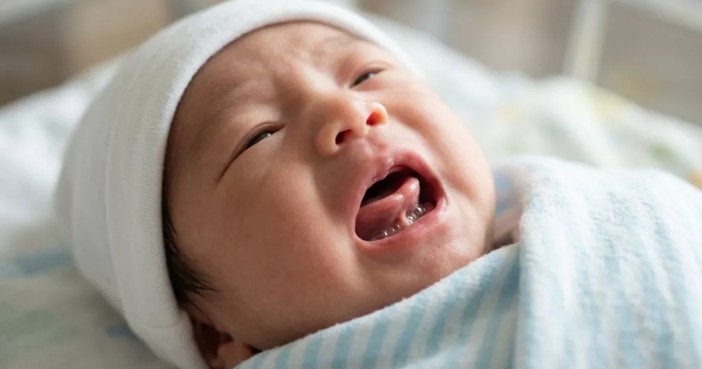 Tongue-Tie Mungkin Punca Bayi Sukar Menyusu, Jangan Terus Salahkan Susu Ibu!