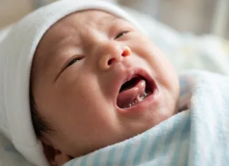 Tongue-Tie Mungkin Punca Bayi Sukar Menyusu, Jangan Terus Salahkan Susu Ibu! Tongue-Tie