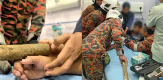 Paku Tertusuk Tapak Tangan