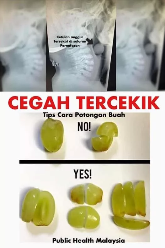 Cara Potong Buah Anggur Dengan Betul, Elak Risiko Kanak-Kanak Tercekik 9 Cara Potong Buah Anggur Dengan Betul, Elak Risiko Kanak-Kanak Tercekik