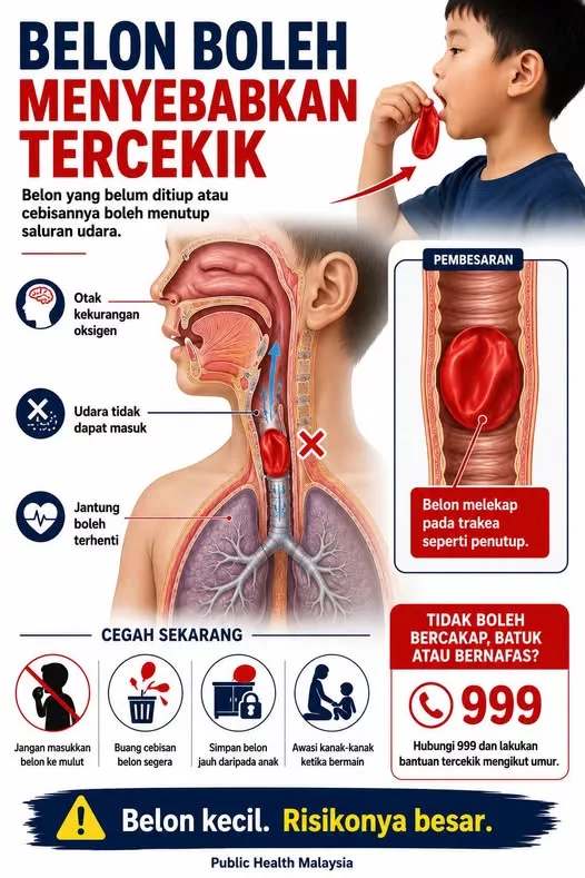 Detik Cemas Disangka Serangan Asma, Rupanya Belon Tersangkut Dalam Saluran Pernafasan Anak 7 Detik Cemas Disangka Serangan Asma, Rupanya Belon Tersangkut Dalam Saluran Pernafasan Anak