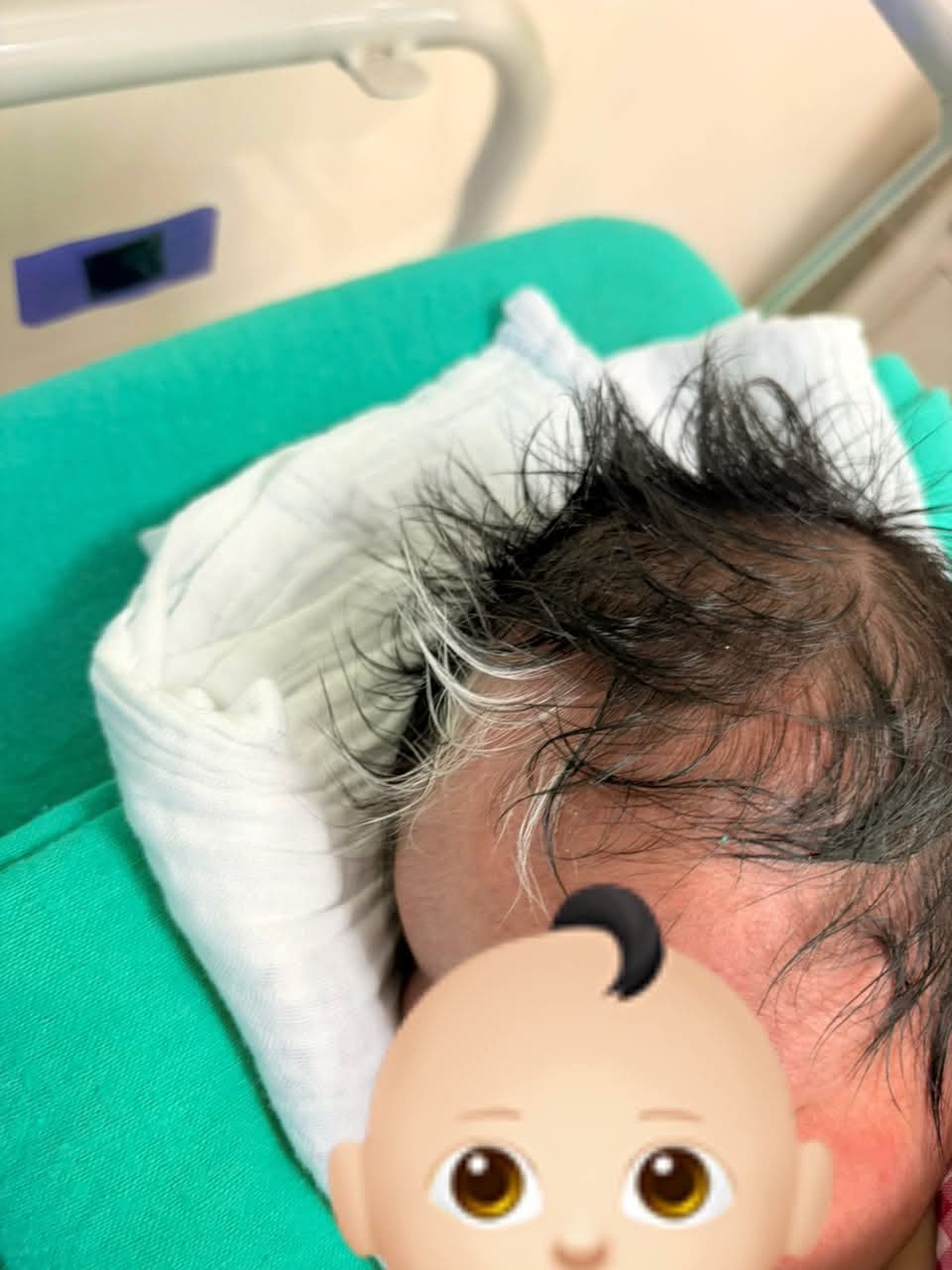 Rambut Bayi Putih Macam ‘Highlight’ Natural Rupanya Ini Tanda Waardenburg Syndrome 7 Rambut Bayi Putih Macam ‘Highlight’ Natural Rupanya Ini Tanda Waardenburg Syndrome