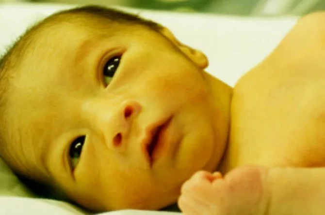 Jaundis Pada Bayi: Jangan Ambil Mudah, Bilirubin Terlalu Tinggi Boleh Jejaskan Otak Bayi 3 Jaundis Pada Bayi: Jangan Ambil Mudah, Bilirubin Terlalu Tinggi Boleh Jejaskan Otak Bayi