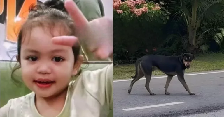Nur Haira Mula Belajar Berjalan Semula, 17 Hari Terlantar Selepas Diserang Anjing! 3 Nur Haira Mula Belajar Berjalan Semula, 17 Hari Terlantar Selepas Diserang Anjing!