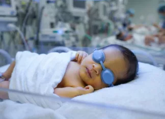 Jaundis Pada Bayi Jangan Dipandang Ringan, Bahaya Bilirubin Tinggi Boleh Jejaskan Otak! Jaundis Pada Bayi Jangan Dipandang Ringan, Bahaya Bilirubin Tinggi Boleh Jejaskan Otak!